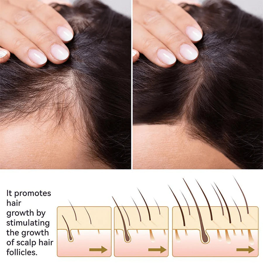 FEG Hair Growth Spray For Both Men & Women - FDA Approved - Made in USA